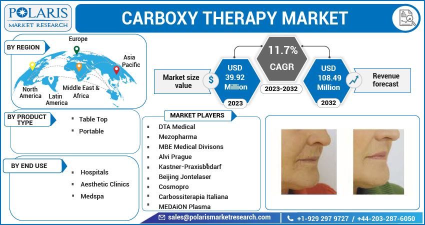 Carboxy Therapy Market Share, Size, Trends